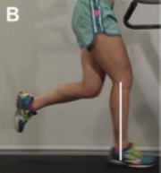 Tibial Angle at Foot Strike