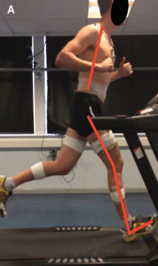 Greater Knee Extension and Increase Ankle Dorsiflexion on Landing