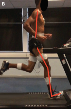 Greater Knee Extension and Increase Ankle Dorsiflexion on Landing